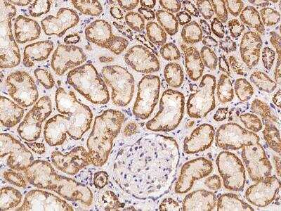Immunohistochemistry-Paraffin: MRPL52 Antibody [NBP3-06249]