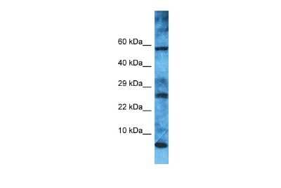 Western Blot: MRPL52 Antibody [NBP2-83230]