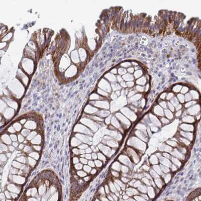 Immunohistochemistry-Paraffin: MRPL53 Antibody [NBP2-31629]