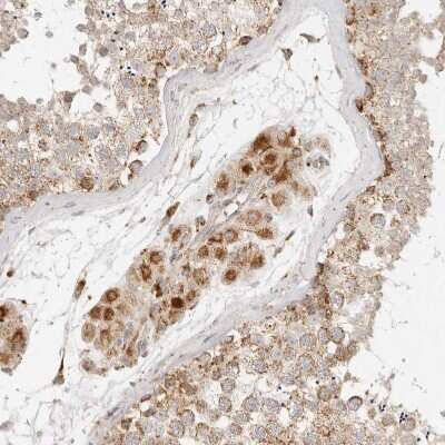 Immunohistochemistry: MRPL55 Antibody [NBP1-91042]