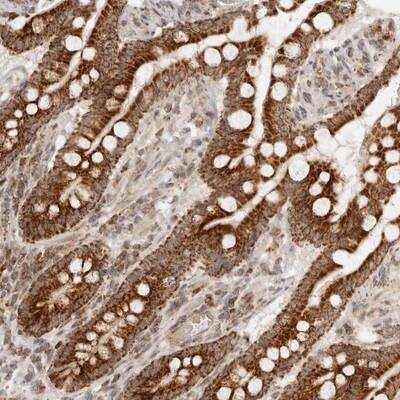Immunohistochemistry-Paraffin: MRPL55 Antibody [NBP1-91042]