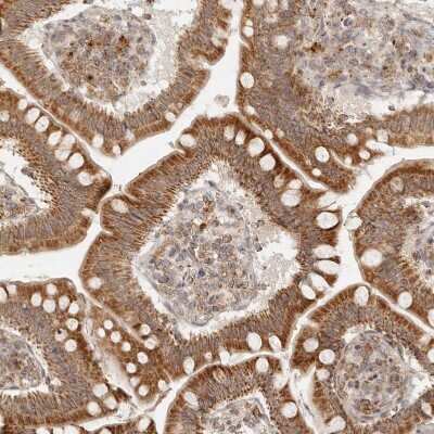 Immunohistochemistry-Paraffin: MRPL55 Antibody [NBP1-91042]