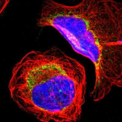 Immunocytochemistry/ Immunofluorescence: MRPL9 Antibody [NBP1-89561]