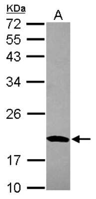 Western Blot: MRPS10 Antibody [NBP2-19409]