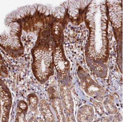 Immunohistochemistry: MRPS11 Antibody [NBP2-30548]