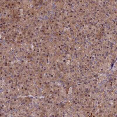 Immunohistochemistry-Paraffin: MRPS11 Antibody [NBP2-30548]
