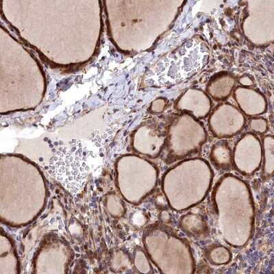 Immunohistochemistry-Paraffin: MRPS11 Antibody [NBP2-30548]