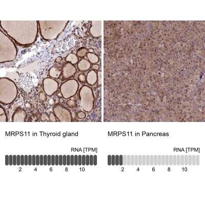 Immunohistochemistry-Paraffin: MRPS11 Antibody [NBP2-30548]