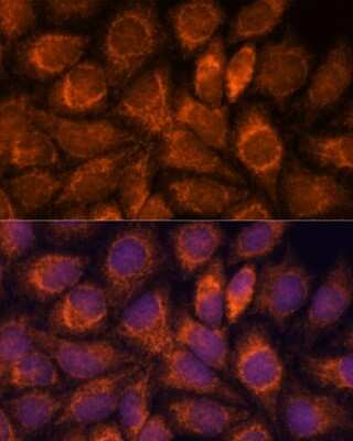 Immunocytochemistry/ Immunofluorescence: MRPS14 Antibody - Azide and BSA Free [NBP2-93952]