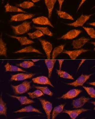Immunocytochemistry/ Immunofluorescence: MRPS14 Antibody - Azide and BSA Free [NBP2-93952]
