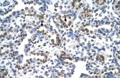 Immunohistochemistry: MRPS15 Antibody [NBP2-87830]