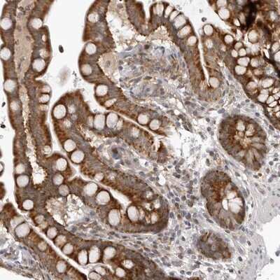 Immunohistochemistry-Paraffin: MRPS15 Antibody [NBP1-87400]