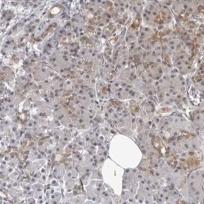 Immunohistochemistry-Paraffin: MRPS15 Antibody [NBP1-87400]