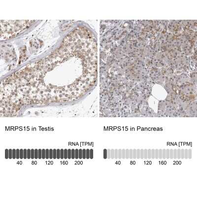 Immunohistochemistry-Paraffin: MRPS15 Antibody [NBP1-87400]
