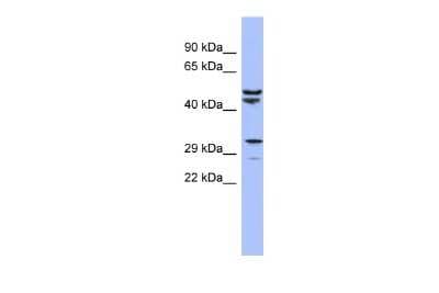 Western Blot: MRPS15 Antibody [NBP2-87831]