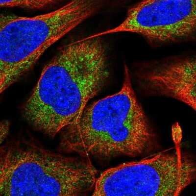 Immunocytochemistry/ Immunofluorescence: MRPS16 Antibody [NBP2-33587]