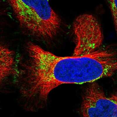 Immunocytochemistry/ Immunofluorescence: MRPS18B Antibody [NBP2-48792]