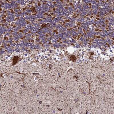 Immunohistochemistry-Paraffin: MRPS18B Antibody [NBP2-48792]
