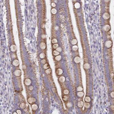 Immunohistochemistry-Paraffin: MRPS2 Antibody [NBP2-33822]
