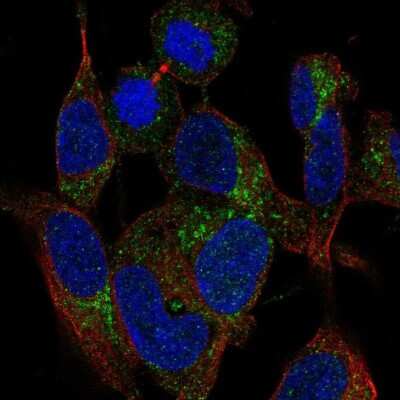 Immunocytochemistry/ Immunofluorescence: MRPS21 Antibody [NBP2-58866]