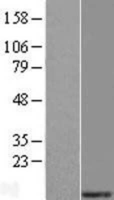 Western Blot: MRPS21 Overexpression Lysate [NBL1-13292]