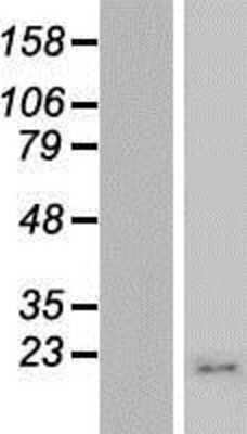 Western Blot: MRPS21 Overexpression Lysate [NBP2-06745]