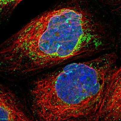 Immunocytochemistry/ Immunofluorescence: MRPS23 Antibody [NBP1-84518]