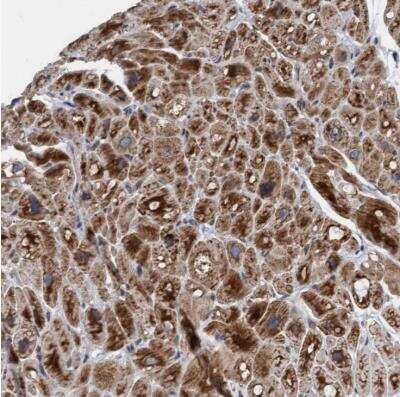 Immunohistochemistry-Paraffin: MRPS23 Antibody [NBP1-84518]