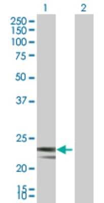 Western Blot: MRPS23 Antibody [H00051649-B01P]