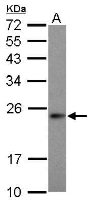 Western Blot: MRPS23 Antibody [NBP2-19412]