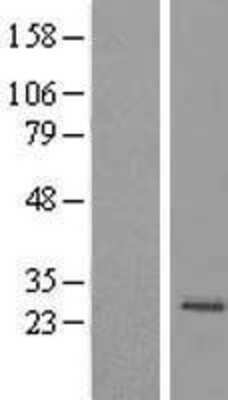 Western Blot: MRPS23 Overexpression Lysate [NBL1-13294]