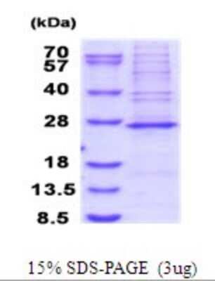 SDS-PAGE: Recombinant Human MRPS23 His Protein [NBP2-51871]