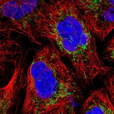 Immunocytochemistry/ Immunofluorescence: MRPS25 Antibody [NBP1-85151]