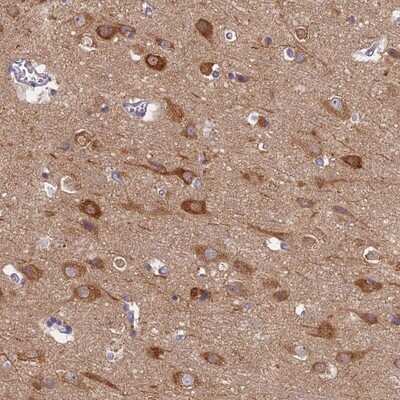 Immunohistochemistry-Paraffin: MRPS25 Antibody [NBP1-85151]