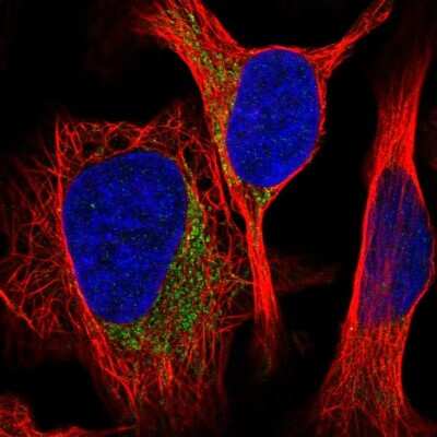 Immunocytochemistry/ Immunofluorescence: MRPS26 Antibody [NBP2-56855]