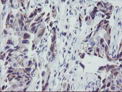 Immunohistochemistry-Paraffin: MRPS27 Antibody (OTI1A2) [NBP2-03888]