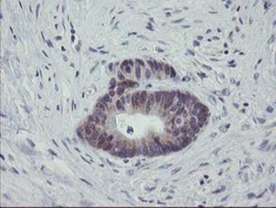 Immunohistochemistry-Paraffin: MRPS27 Antibody (OTI1A2) [NBP2-03888]