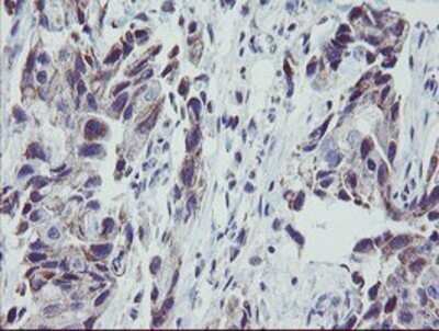 Immunohistochemistry: MRPS27 Antibody (OTI1A2) - Azide and BSA Free [NBP2-72784]