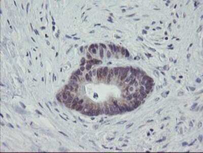 Immunohistochemistry: MRPS27 Antibody (OTI1A2) - Azide and BSA Free [NBP2-72784]