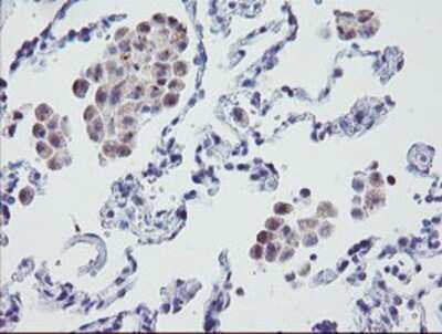 Immunohistochemistry: MRPS27 Antibody (OTI1A2) - Azide and BSA Free [NBP2-72784]