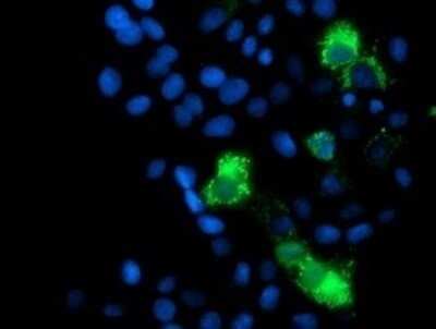 Immunocytochemistry/ Immunofluorescence: MRPS27 Antibody (OTI6E5) - Azide and BSA Free [NBP2-72787]
