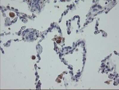 Immunohistochemistry: MRPS27 Antibody (OTI6E5) [NBP2-45938]