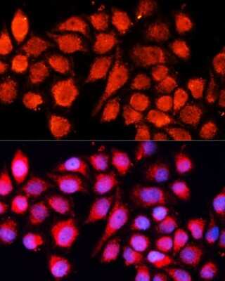 Immunocytochemistry/ Immunofluorescence: MRPS28 Antibody - Azide and BSA Free [NBP2-93219]