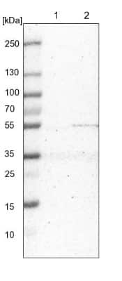 Western Blot: MRPS30 Antibody [NBP1-87343]