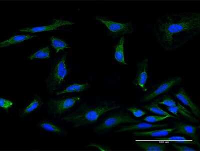 Immunocytochemistry/ Immunofluorescence: MRPS34 Antibody [H00065993-B01P]