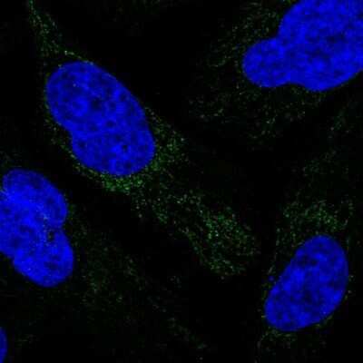Immunocytochemistry/ Immunofluorescence: MRPS34 Antibody [NBP1-82729]