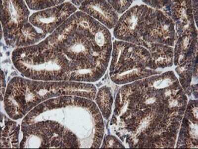 Immunohistochemistry: MRPS34 Antibody (OTI4H2) [NBP2-45432]