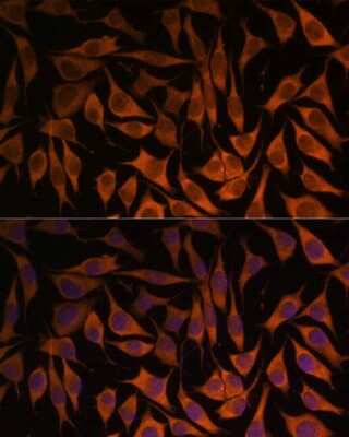 Immunocytochemistry/ Immunofluorescence: MRPS35 Antibody - Azide and BSA Free [NBP2-94003]