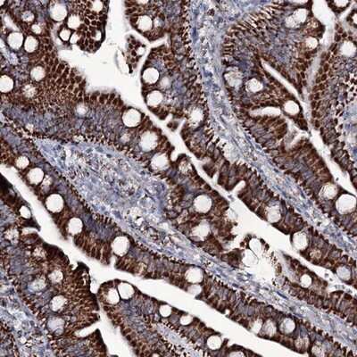 Immunohistochemistry-Paraffin: MRPS35 Antibody [NBP1-82786]