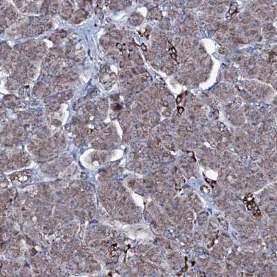 Immunohistochemistry-Paraffin: MRPS35 Antibody [NBP1-82786]